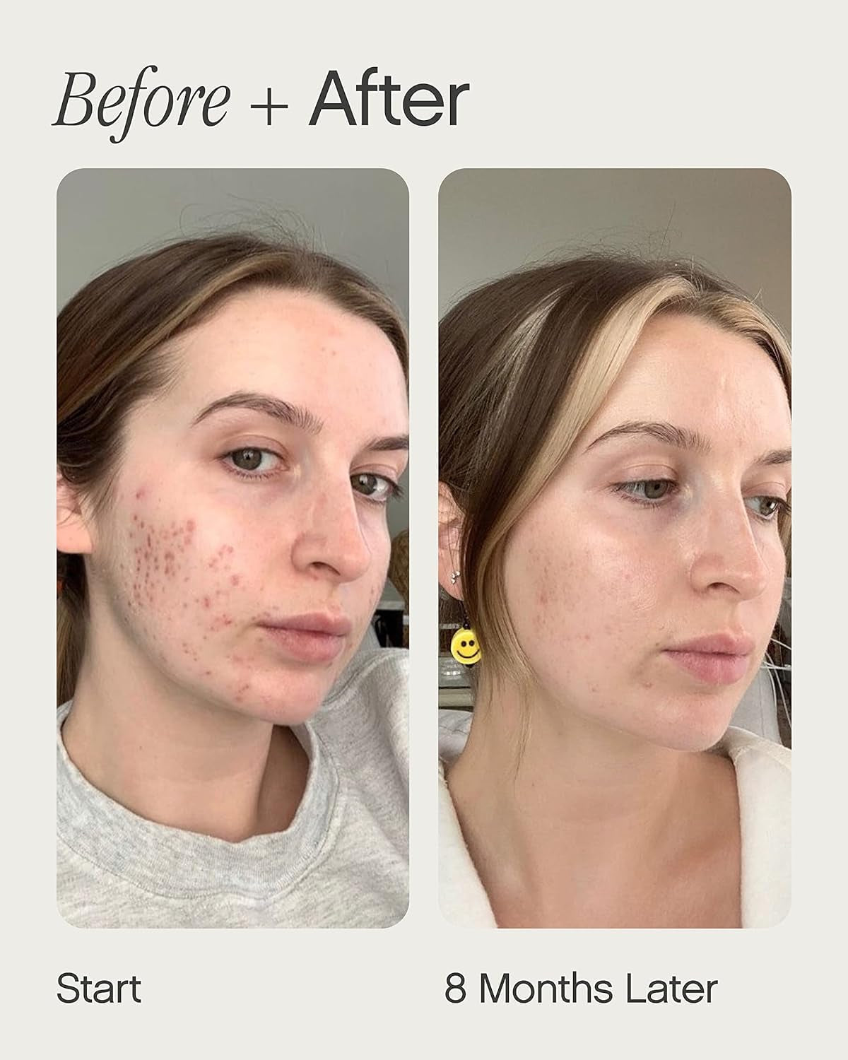 Faded Brightening and Clearing Serum | Reduces Discoloration Post-Blemish Marks Scars Spots Contains Kojic Acid Niacinamide Dermatologist-Tested Vegan Cruelty-Free Fl Oz