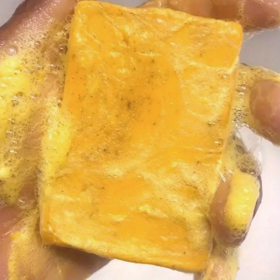 Kojic Acid Dark Spot Remover Soap Bars