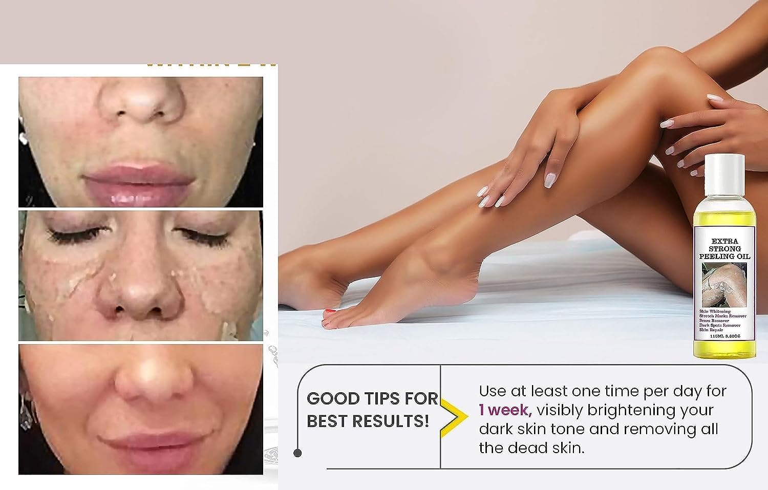 Yellow Peeling Oil, Peeling Oil for Dark Skin, Strong Peeling Oil Extra Strength, Exfoliating Peeling Solution for Body All Skin Type Dead Skin Remover (3.87 Fl Oz / 110ML)