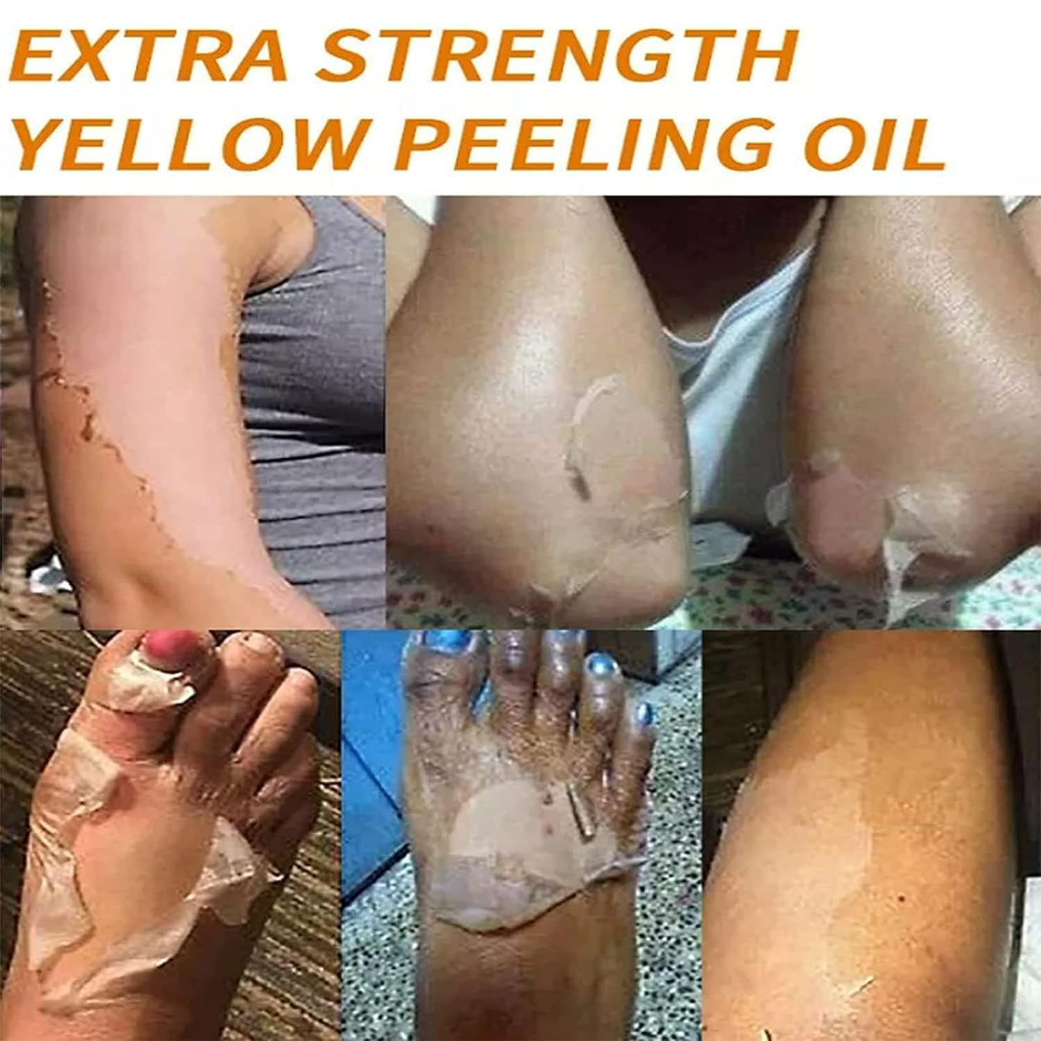 Yellow Peeling Oil, Peeling Oil for Dark Skin, Strong Peeling Oil Extra Strength, Exfoliating Peeling Solution for Body All Skin Type Dead Skin Remover (3.87 Fl Oz / 110ML)