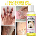 Yellow Peeling Oil, Peeling Oil for Dark Skin, Strong Peeling Oil Extra Strength, Exfoliating Peeling Solution for Body All Skin Type Dead Skin Remover (3.87 Fl Oz / 110ML)