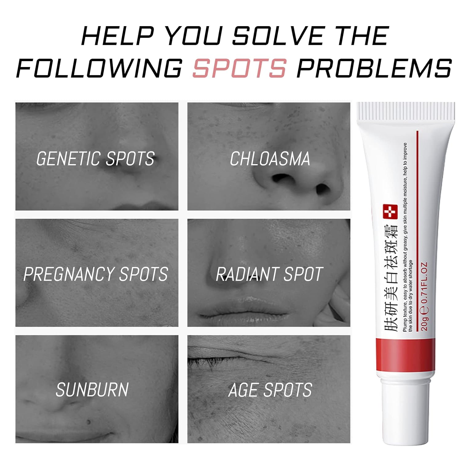 2 Pcs Whitening Freckle Cream, Acne Scar Removal Treatment Cream, Pigmentation Removal Cream for Face, Moisturizing Removes Facial Melasma Dark Spots Wrinkles Blemishes (Whitening Freckle Cream)