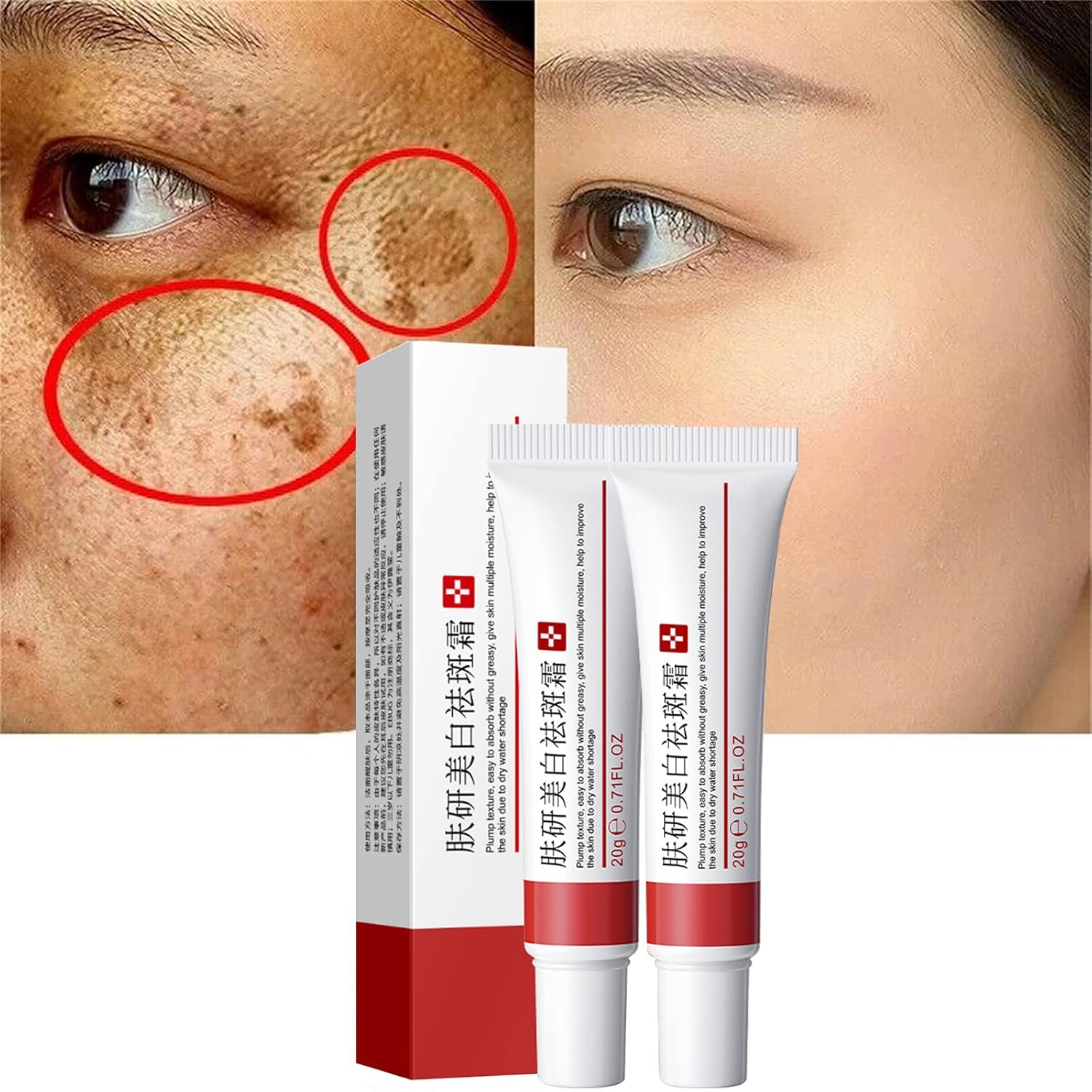 2 Pcs Whitening Freckle Cream, Acne Scar Removal Treatment Cream, Pigmentation Removal Cream for Face, Moisturizing Removes Facial Melasma Dark Spots Wrinkles Blemishes (Whitening Freckle Cream)