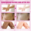 Yellow Peeling Oil, Peeling Oil for Dark Skin, Strong Peeling Oil Extra Strength, Exfoliating Peeling Solution for Body All Skin Type Dead Skin Remover (3.87 Fl Oz / 110ML)