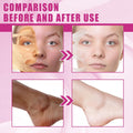 Yellow Peeling Oil, Peeling Oil for Dark Skin, Strong Peeling Oil Extra Strength, Exfoliating Peeling Solution for Body All Skin Type Dead Skin Remover (3.87 Fl Oz / 110ML)