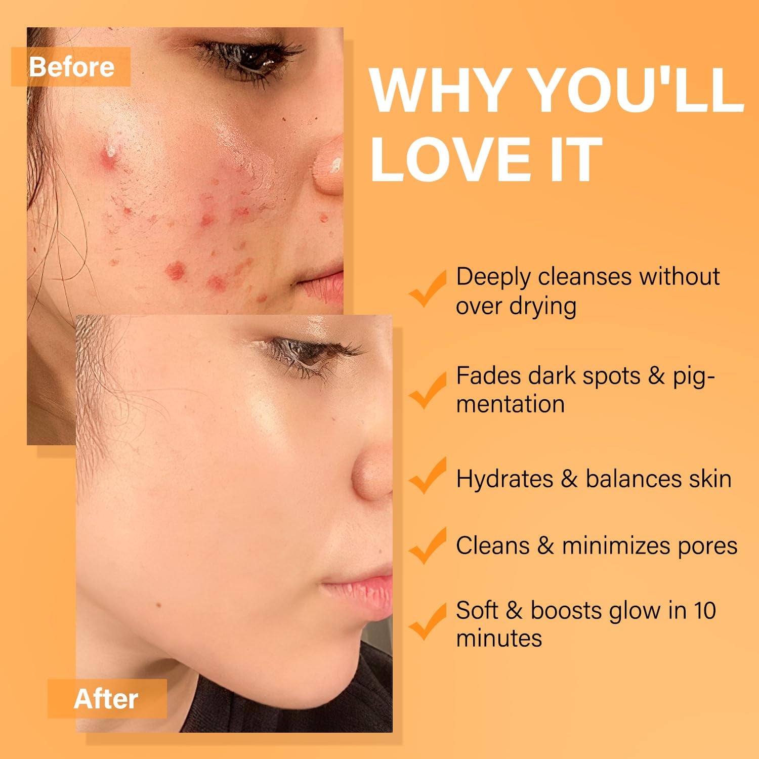 Facial Clay Mask Set - Vitamin C Face Mask with Turmeric, Dead Sea Mud & Salicylic Acid Mask for Pores Cleansing, Blackheads, Dark Spots, Brightening, Face Masks Skincare Gift for Women, 2.82 Oz Each