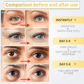 24K Gold under Eye Patches - 60 Pack for Puffy Eyes, Dark Circles, Bags & Wrinkles with Collagen & Hyaluronic Acid